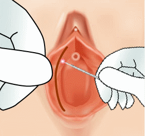 ¼ÒÀ½¼ø Ãà¼Ò ¼ºÇü¼ú