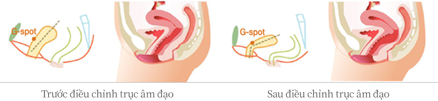 �� �̿����� BR �� ��Ҽ���